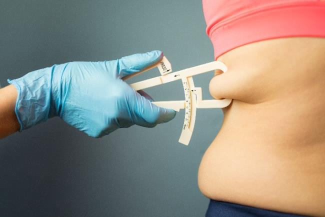 רופא מודד לאישה אחוזי שומן בגוף לפני ביצוע ניתוח שאיבת שומן בלייזר